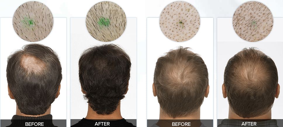 Rejuvalex-review-after use